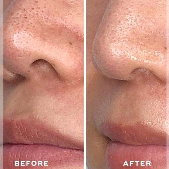 ACEOLOGY DETOXIFYING TREATMENT MASK•65 ml - Picture 5 of 8